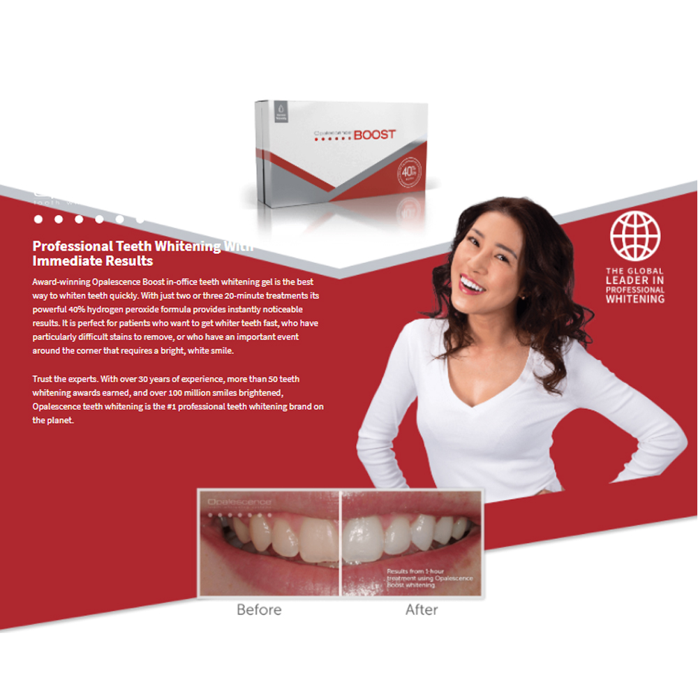 Teeth Whitening Gel Opalescence - Opalescence Boost 40% PF American Ultradent