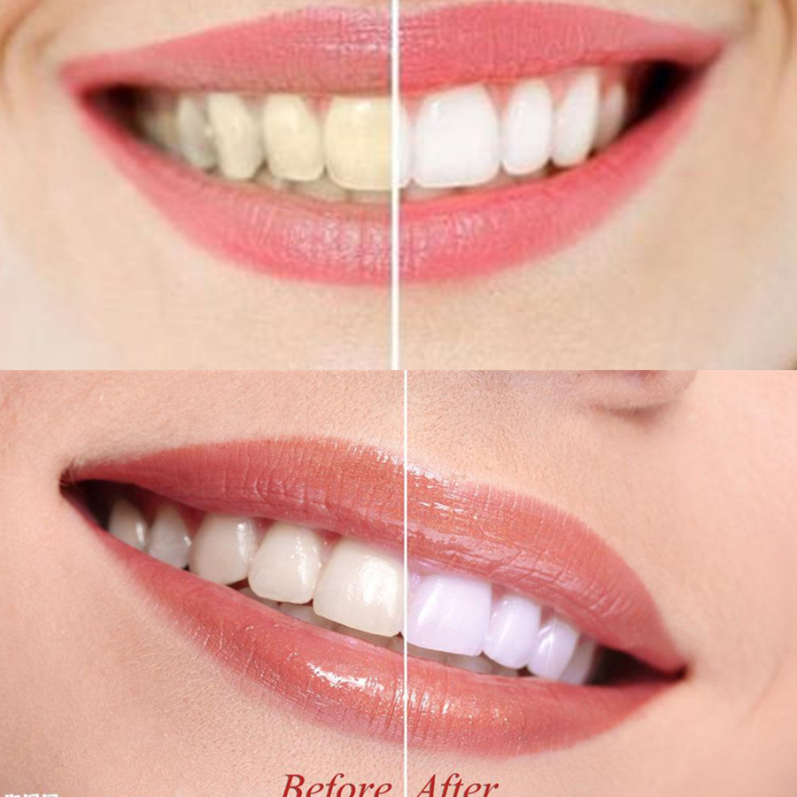 Bambusowy węgiel drzewny zęby  – Teeth Whitening Ingredients recenzja i cena