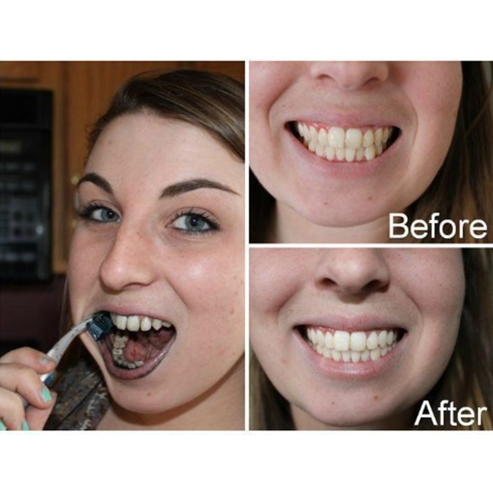 Bambusowy węgiel drzewny zęby  – Teeth Whitening Ingredients recenzja i cena