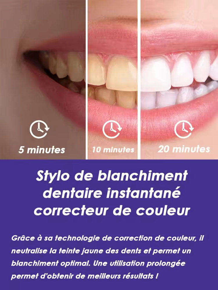 Zestaw do wybielania zębów 8ml – Teeth Whitening Gel Pen recenzja i cena