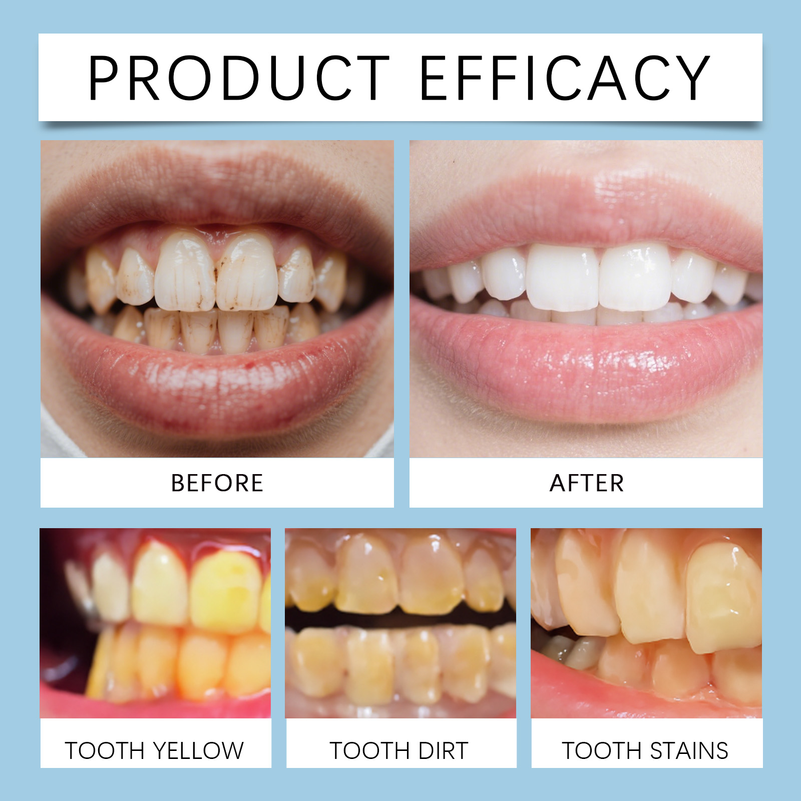 Feimuko 8ml Żelowy długopis do – Teeth Whitening Gel Pen recenzja i cena
