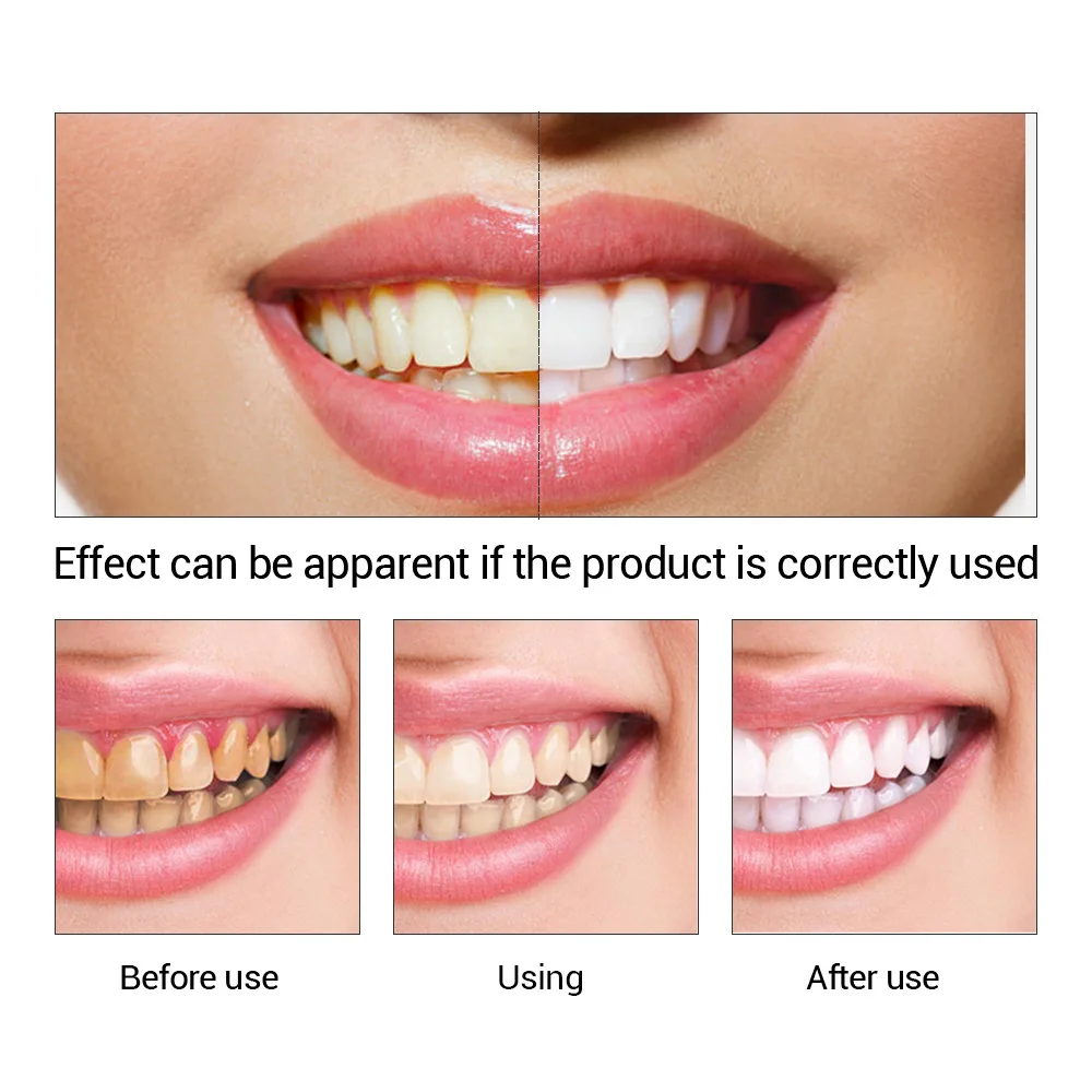 FTEENPLY esencja do wybielania – Teeth Whitening Ingredients recenzja i cena