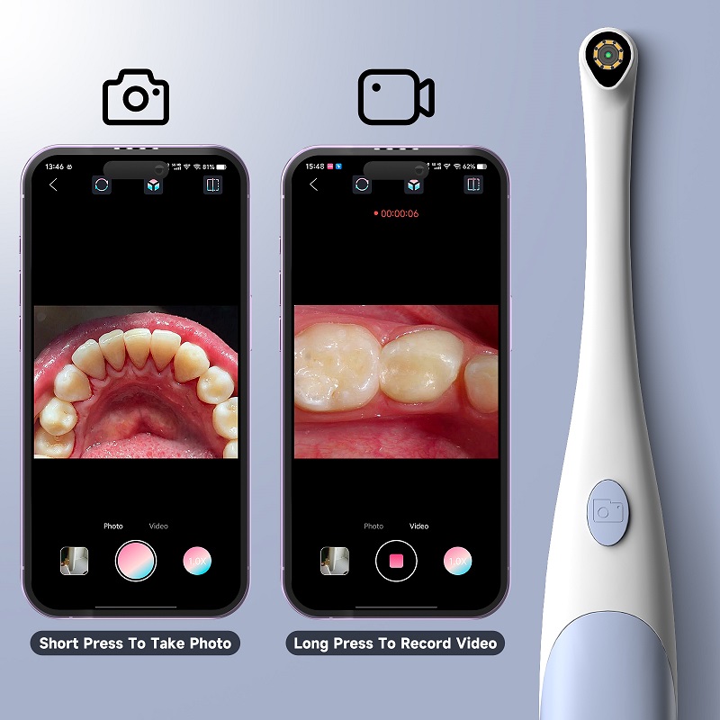 Kamera endoskopowa do inspekcj – Teeth Whitening Video recenzja i cena