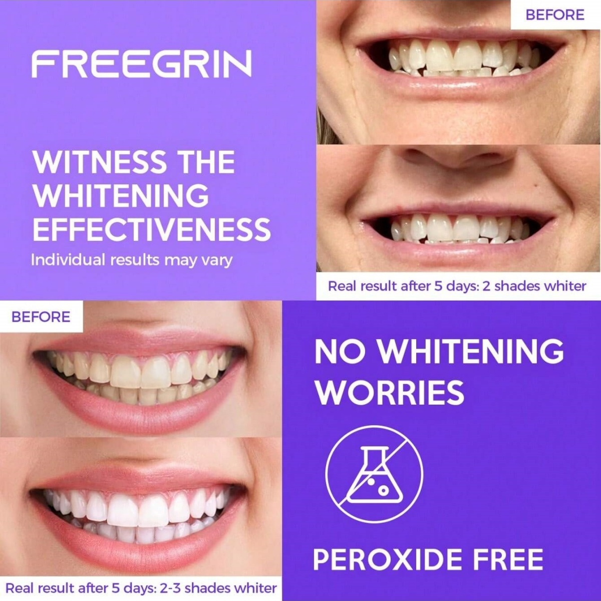 Naklejki wybielające do zębów  – Teeth Whitening With Peroxide recenzja i cena